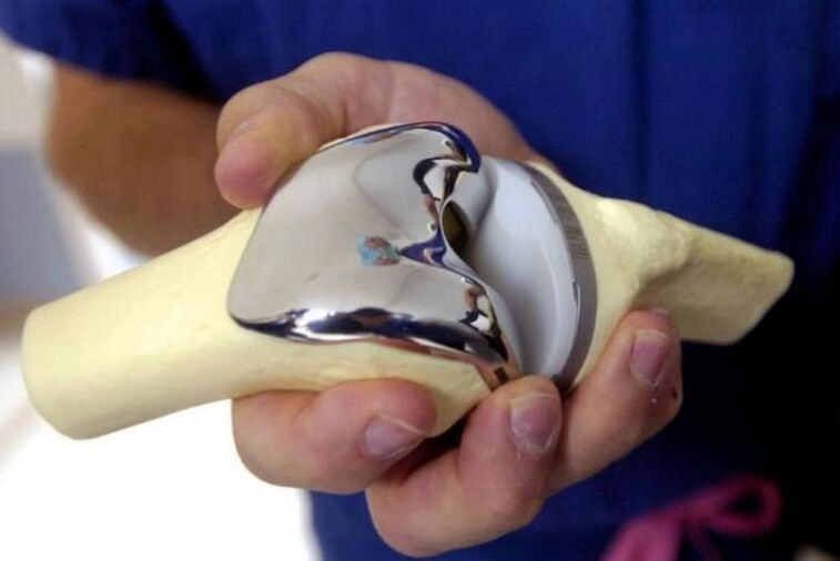 Intra-articular prosthesis