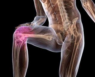 Arthritis and knee joint inflammation