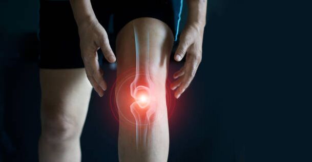 Knee joints
