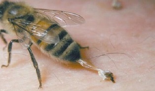 Bees treat hip joint disease