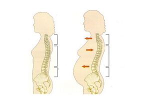 What can cause back pain